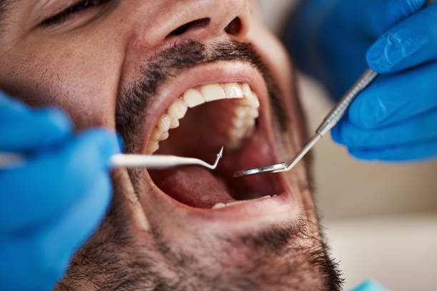 Best Emergency Dental Care for Broken or Chipped Teeth in Laurel Park, NC